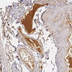 LBP Antibody, Novus Biologicals:Antibodies:Primary Antibodies